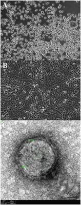 <mark class="highlighted">Co-circulation</mark> of a Novel Dromedary Camel Parainfluenza Virus 3 and Middle East Respiratory Syndrome Coronavirus in a Dromedary Herd With Respiratory Tract Infections